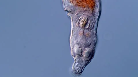 Rotifer under microscopy view 400x magnification 库存影片 310312850