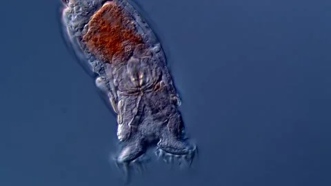 Rotifer under microscopy view 400x magnification 库存影片 310313414