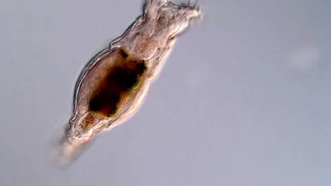 Rotifer under microscopy view (400x magnification) Vídeos de archivo 310646201