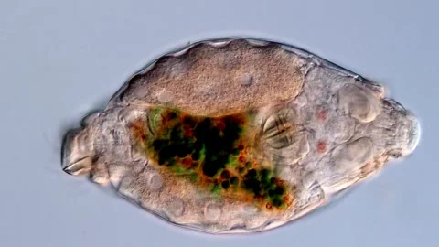 Rotifer under microscopy view 400x magnification 库存影片 310647177