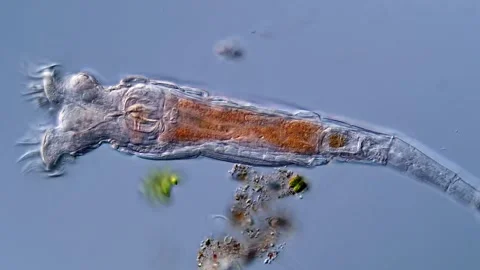 Rotifer under the microscopy view Vídeos de archivo 310306191