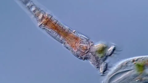 Rotifer under microscopy view 库存影片 310307105