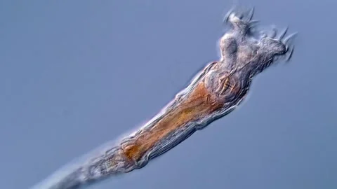 Rotifer under microscopy view Vídeos de archivo 310307970