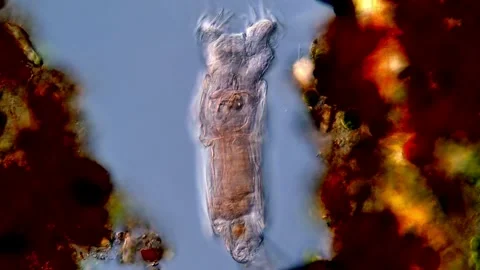 Rotifer under the microscopy view 库存影片 310310970