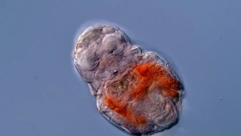 Rotifer under the microscopy view 库存影片 310312294
