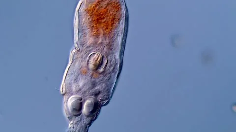 Rotifer under microscopy view 库存影片 310312875