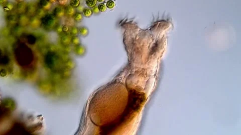Rotifer under microscopy view 库存影片 310646083