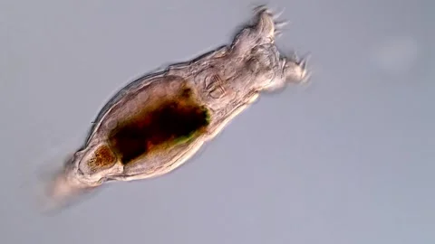Rotifer under microscopy view 库存影片 310646218
