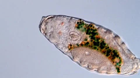 Rotifer under microscopy view 스톡 동영상 310646446