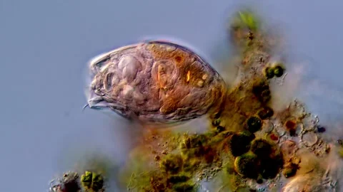 Rotifer under microscopy view 库存影片 310647474