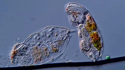 Rotifer under microscopy view 库存影片 310647806