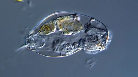 Rotifer under microscopy view Vídeos de archivo 310649044