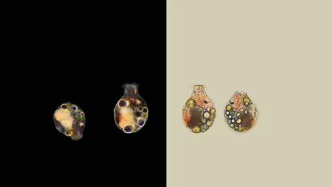 Rotifera Gastropus sp. under the microscope, the family Gastropodidae Stock Footage 139876125