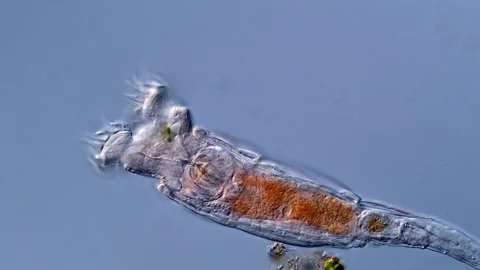 Rotifera (Rotifer in pond water under mi... | Stock Video | Pond5