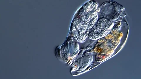 Rotifera (Rotifer under microscope) 库存影片 310648292