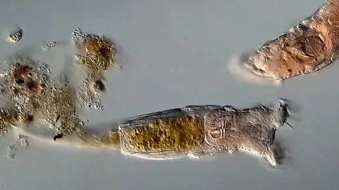 Rotifera under microscope 400x magnification 库存影片 306579504
