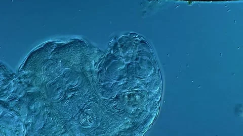 Rotifera under microscope 400x magnification 库存影片 306585825