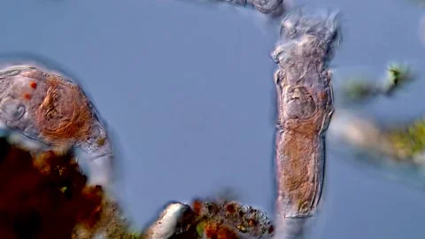Rotifera under microscope 400x magnification 库存影片 310310508