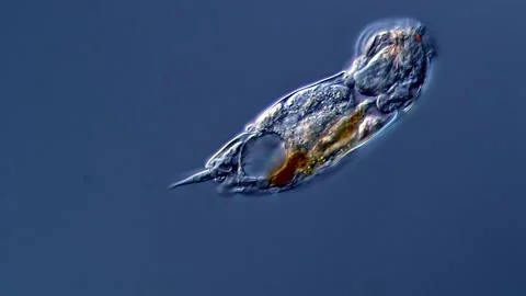 Rotifera under microscope 400x magnification 库存影片 310313463