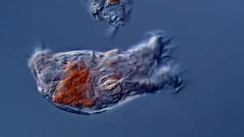 Rotifera under microscope 400x magnification 库存影片 310313571