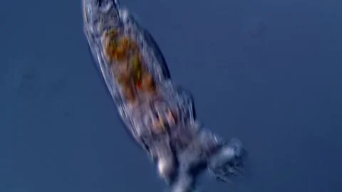 Rotifera under microscope 400x magnification 库存影片 310313713