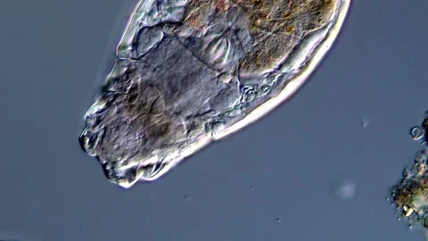 Rotifera under microscope 400x magnification 库存影片 310648723