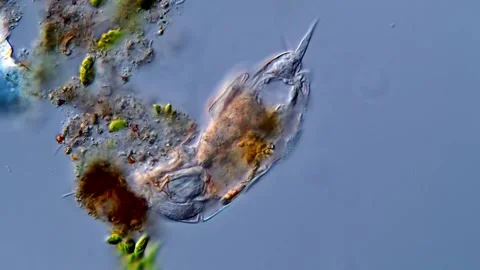Rotifera under the microscope 스톡 동영상 310312046