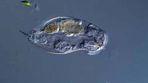 Rotifera under microscope 库存影片 310649733