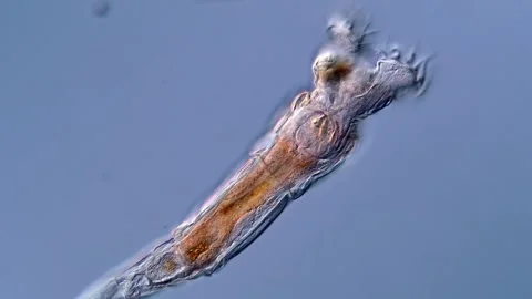 Rotifera under microscopy view 库存影片 310307104