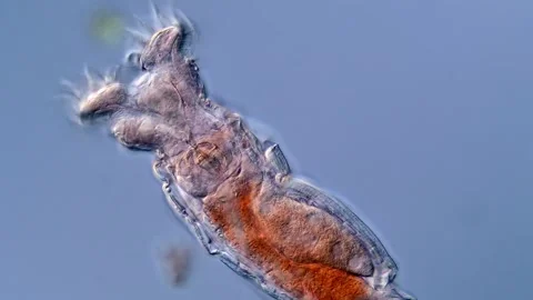 Rotifera under microscopy view, water sample 400x magnification 库存影片 310309322