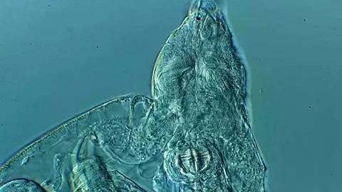 Rotifers inside a rotifera under microscopy view Vídeos de archivo 306580972