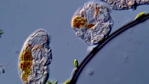 Rotifers under DIC microscopy view 库存影片 310647735