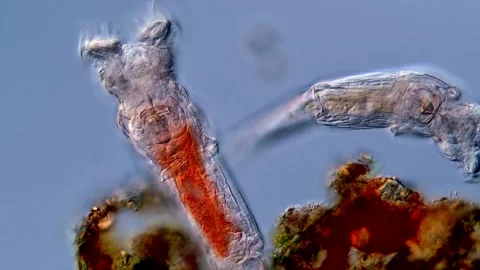 Rotifers under microscope 400x magnification Vídeos de archivo 310311247