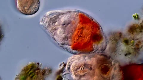 Rotifers under microscope Vídeos de archivo 310657170