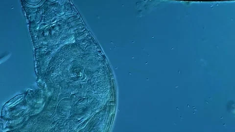 Rotifers under microscopy view, 400x magnification Vídeos de archivo 306584058