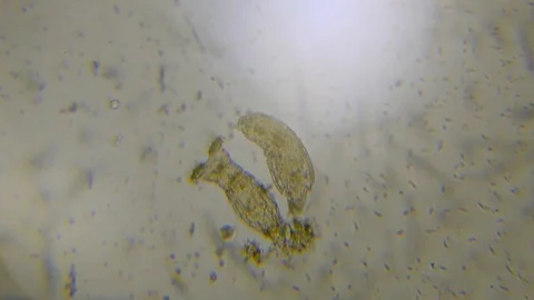 Rotifier under microscope footage Stock Footage 110620294