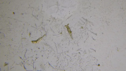 Rotifier under microscope footage Stock Footage 110620356