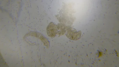 Rotifier under microscope footage Stock Footage 110620372