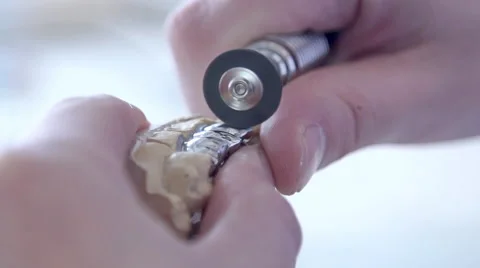 Rough dental cast polishing Stock Footage 59807149