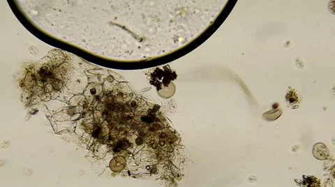 Roundworm and Arcella Shells Video stock 38423645