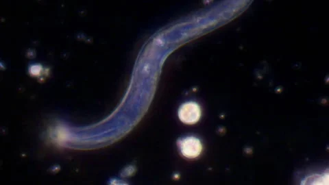 A roundworm on a dark background Video stock 339321895