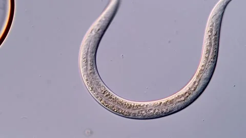 Roundworm nematode larvae under microscopy 스톡 동영상 310495129