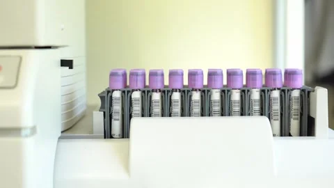 A row of blood sample vials with purple caps inside a medical laboratory Stock Footage 296326454