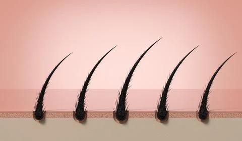Row of multiple damaged weak hair strands growing on scalp - 3d illustration Stock Illustration
