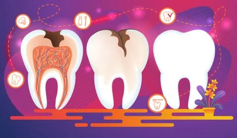 Row of Teeth with Dental Problems. Cross Section. Stock Illustration