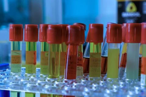 A row of test tubes with different colored caps and labels Stock Photos