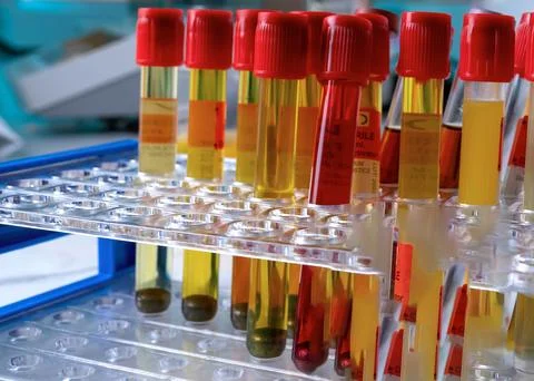 A row of test tubes with different colored liquids in them Stock Photos