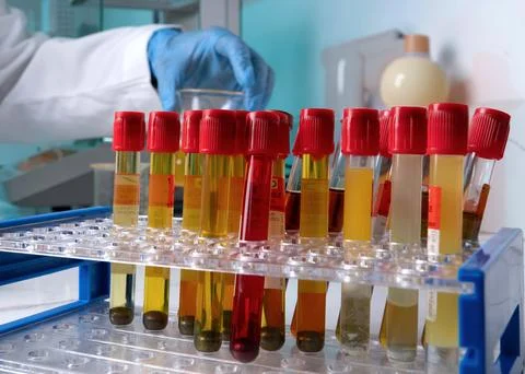 A row of test tubes with red lids and yellow liquid inside Stock Photos