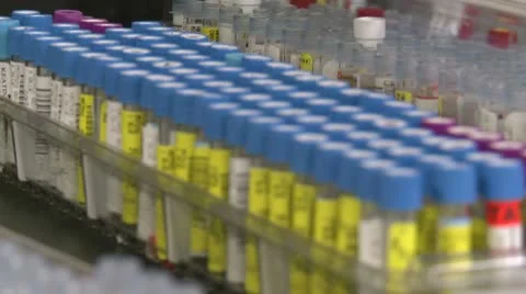Rows of test tubes Stock Footage 10757552