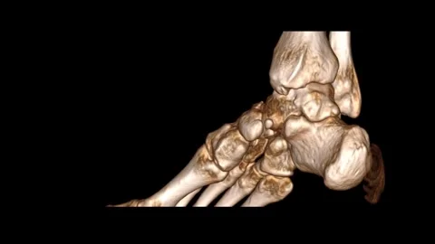 RT foot Plain Stnd Thin-VR-movie Stock Footage 285256531
